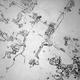 Image for article titled Tears of joy and tears of sadness look different under the microscope